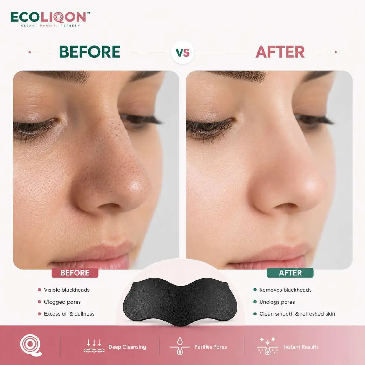 ECOLIQON Charcoal Nose Strips